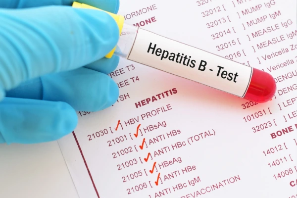 Hepatitis C and B Screening and Management